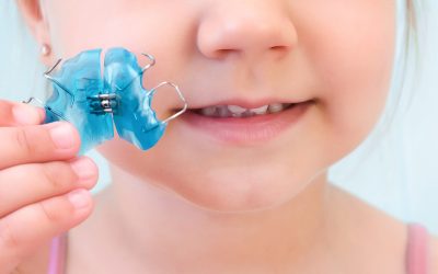 Dental plate. Expansion of the jaw in a child. A plate to heaven. There is not enough room for the molars. Happy girl holding an orthodontic plate in her hands