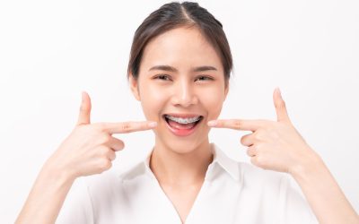 Face of a young smiling asian woman with braces on teeth, Orthodontic Treatment.